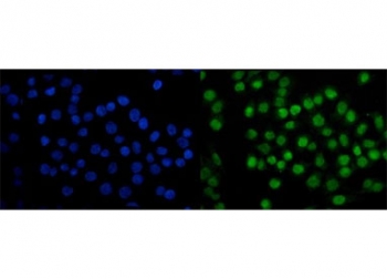Immunofluorescent staining of FFPE human Caco-2 cells with SAMHD1 antibody (green) and DAPI nuclear stain (blue). HIER: steam section in pH6 citrate buffer for 20 min.