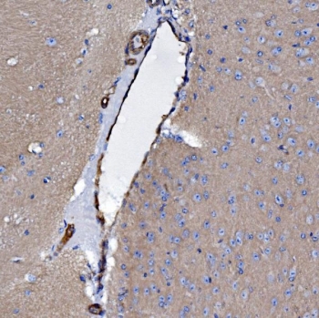 IHC staining of FFPE mouse brain tissue with EHD3 antibody. HIER: boil tissue sections in pH8 EDTA for 20 min and allow to cool before testing.