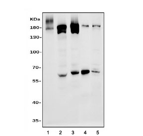 Western blot testing of 1) human Jurkat, 2) human HEK293, 3) human K562, 4) rat pancreas and 5) mouse pancreas tissue lysate with EPRS antibody. Predicted molecular weight ~171 kDa.