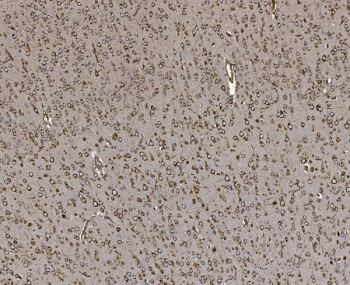 IHC staining of FFPE rat brain tissue with EPRS antibody. HIER: boil tissue sections in pH8 EDTA for 20 min and allow to cool before testing.