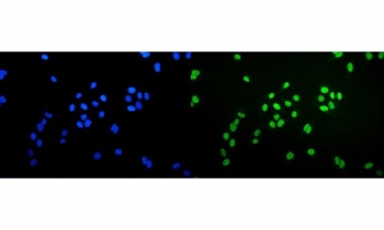 Ku70 Antibody U-2 OS Immunofluorescence. Immunofluorescent analysis of FFPE human U-2 OS cells stained with Ku70 Antibody demonstrates strong nuclear-associated green fluorescence consistent with XRCC6 / Ku70 localization within DNA damage response and chromatin-associated repair compartments. This DNA end binding protein antibody highlights non-homologous end joining-associated genomic maintenance pathways in osteosarcoma-derived cells. Nuclei are counterstained with DAPI nuclear stain (blue). HIER: steam section in pH6 citrate buffer for 20 min.