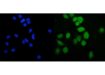 Immunofluorescent staining of FFPE human PC-3 cells with Phospholipid transfer protein antibody (green) and DAPI nuclear stain (blue). HIER: steam section in pH6 citrate buffer for 20 min.