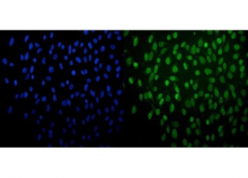 Immunofluorescent staining of FFPE human HeLa cells with PRDM14 antibody (green) and DAPI nuclear stain (blue). HIER: steam section in pH6 citrate buffer for 20 min.
