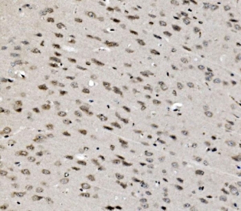 IHC staining of FFPE mouse brain tissue with TBP associated factor 4 antibody. HIER: boil tissue sections in pH8 EDTA for 20 min and allow to cool before testing.