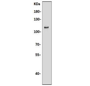 Western blot testing of human Raji cell lysate with TICAM1 antibody. Predicted molecular weight: 76 kDa but routinely observed at 70-150 kDa.