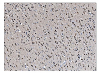 IHC staining of FFPE rat brain tissue with VAMP4 antibody. HIER: boil tissue sections in pH8 EDTA for 20 min and allow to cool before testing.