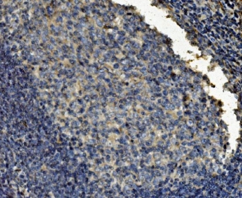 IHC staining of FFPE human tonsil tissue with Clathrin heavy chain antibody. HIER: boil tissue sections in pH8 EDTA for 20 min and allow to cool before testing.