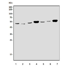Western blot testing of 1) human HL60, 2) human ThP-1, 3) rat brain, 4) rat heart, 5) mouse brain, 6) mouse kidney and 7) mouse heart tissue lysate with ACVRL1 antibody. Predicted molecular weight ~56 kDa.