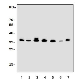 Western blot testing of human 1) HL60, 2) K562, 3) Raji, 4) Jurkat, 5) rat RH35, 6) mouse spleen and 7) mouse ANA-1 cell lysate with CD154 antibody. Expected molecular weight: 29-39 kDa (depending on glycosylation level) or ~18 kDa (soluble form).