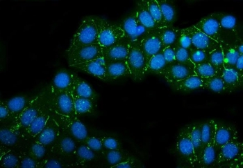 Immunofluorescent staining of FFPE human MCF7 cells with Claudin 3 antibody (green) and DAPI nuclear stain (blue). HIER: steam section in pH6 citrate buffer for 20 min.