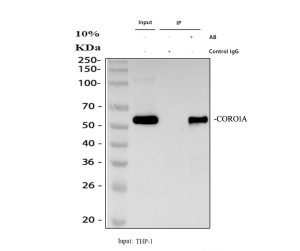 Coronin 1A Antibody Human THP-1 Monocyte IP. Immunoprecipitation of Coronin 1A from human THP-1 monocytic cell lysate using Coronin 1A Antibody / TACO Antibody. Lane 1: 30 ug THP-1 whole cell lysate input; Lane 2: rabbit control IgG with THP-1 lysate; Lane 3: 2 ug Coronin 1A antibody with 500 ug THP-1 whole cell lysate. Immunoprecipitated protein was detected by western blot using Coronin 1A antibody at 0.5 ug/ml followed by goat anti-rabbit IgG-HRP light-chain secondary antibody and ECL detection. A specific band was detected at approximately 57 kDa, consistent with the expected molecular weight of CORO1A.