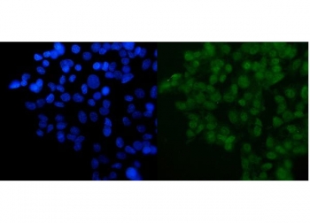 Immunofluorescent staining of FFPE human HepG2 cells with DYNLL1 antibody (green) and DAPI nuclear stain (blue). HIER: steam section in pH6 citrate buffer for 20 min.