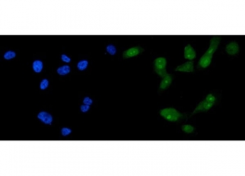 Immunofluorescent staining of FFPE human PC-3 cells with FOXA2 antibody (green) and DAPI nuclear stain (blue). HIER: steam section in pH6 citrate buffer for 20 min.