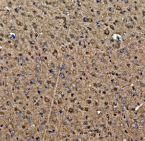 IHC staining of FFPE mouse brain tissue with Glutamic-oxaloacetic transaminase 1 antibody. HIER: boil tissue sections in pH8 EDTA for 20 min and allow to cool before testing.