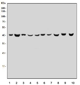 Western blot testing of human 1) placenta, 2) T-47D, 3) HepG2, 4) Caco-2, 5) HL60, 6) K562, 7) HeLa, 8) rat brain, 9) mouse brain and 10) mouse liver tissue lysate with Glutamic-oxaloacetic transaminase 1 antibody. Predicted molecular weight ~41 kDa.