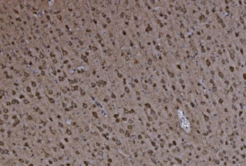 IHC staining of FFPE mouse brain tissue with Glutamate-oxaloacetate transaminase 2 antibody. HIER: boil tissue sections in pH8 EDTA for 20 min and allow to cool before testing.
