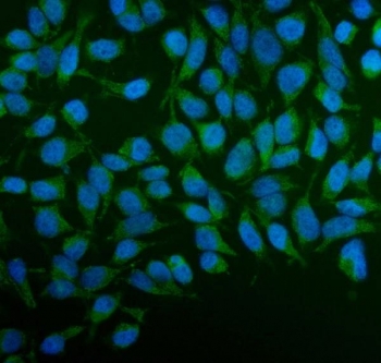 Immunofluorescent staining of FFPE human HeLa cells with PFKFB2 antibody (green) and DAPI nuclear stain (blue). HIER: steam section in pH6 citrate buffer for 20 min.