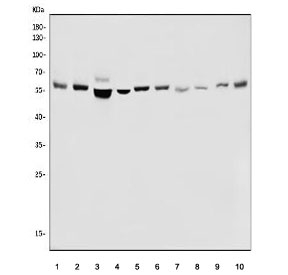 Western blot testing of human 1) K562, 2) HepG2, 3) Caco-2, 4) HeLa, 5) A431, 6) PC-3, 7) rat heart, 8) rat PC-12, 9) mouse heart and 10) mouse RAW364.7 cell lysate with PFKFB2 antibody. Predicted molecular weight ~58 kDa.