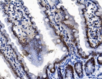 Pycard Antibody Mouse Intestine IHC. Immunohistochemical staining of FFPE mouse intestine tissue using PYCARD Antibody / Inflammasome Adaptor Protein Antibody. PYCARD expression is detected predominantly within the cytoplasm of intestinal epithelial cells, consistent with its role as a central adaptor protein in inflammasome assembly, innate immune signaling, and regulation of mucosal inflammatory responses. Heat-induced epitope retrieval was performed by boiling tissue sections in pH 8 EDTA buffer for 20 minutes and allowing them to cool prior to immunostaining.