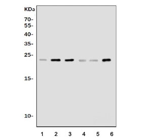 Pycard Antibody WB. Western blot analysis of 1) rat lung, 2) rat spleen, 3) rat thymus, 4) mouse lung, 5) mouse spleen, and 6) mouse thymus tissue lysates using PYCARD Antibody / Inflammasome Adaptor Protein Antibody. A distinct immunoreactive band is detected at approximately 22 kDa across all tissue lysates, consistent with the predicted molecular weight of PYCARD (ASC), supporting specific detection of the endogenous inflammasome adaptor protein in both rat and mouse tissues.