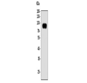 Western blot testing of mouse lung tissue lysate with Slc44a2 antibody. Predicted molecular weight ~80 kDa.