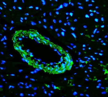 Immunofluorescent staining of FFPE rat heart tissue with TAGLN antibody (green) and DAPI nuclear stain (blue). HIER: steam section in pH8 EDTA buffer for 20 min.