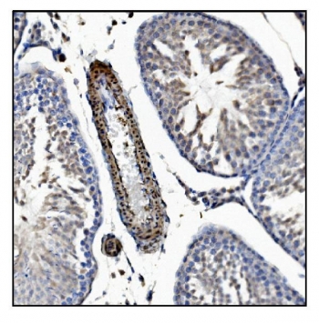 IHC staining of FFPE rat testis tissue with TAGLN antibody. HIER: boil tissue sections in pH8 EDTA for 20 min and allow to cool before testing.