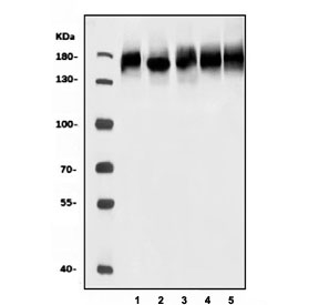 Western blot testing of 1) human Jurkat, 2) human K562, 3) human HEK293, 4) rat brain and 5) mouse brain tissue lysate with Breakpoint cluster region protein antibody. Expected molecular weight: 130-190 kDa (multiple isoforms).