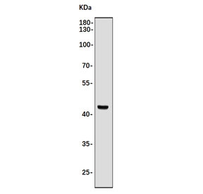 Western blot testing of human Jurkat cell lysate with CASP9 antibody. Expected molecular weight: 45-50 kDa.
