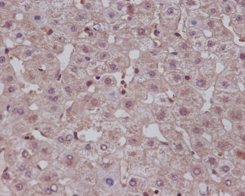 NOTCH1 Antibody Human Liver IHC. Immunohistochemistry staining of FFPE human liver tissue using NOTCH1 antibody demonstrates diffuse cytoplasmic and membranous staining within hepatocyte populations, consistent with expression of NOTCH1, a transmembrane receptor that functions as a central regulator of the Notch signaling pathway. NOTCH1 mediates cell-to-cell communication and influences transcriptional programs involved in cell fate determination, differentiation, tissue homeostasis, and regenerative responses. The observed staining pattern is consistent with the established role of NOTCH1 in maintaining cellular signaling networks that regulate tissue organization and liver physiology. These findings support the utility of NOTCH1 antibody for studies of developmental signaling, tissue regeneration, and signal transduction pathways in human tissues.