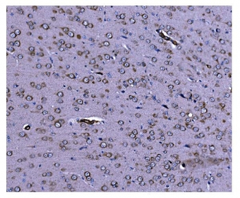 IHC staining of FFPE rat brain tissue with Caspase 9 antibody. HIER: boil tissue sections in pH8 EDTA for 20 min and allow to cool before testing.