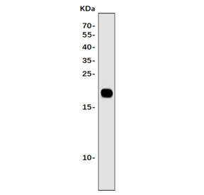 Western blot testing of human Caco-2 cell lysate with Claudin 2 antibody. Predicted molecular weight ~25 kDa.