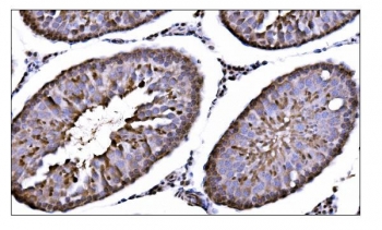 IHC staining of FFPE rat testis tissue with CAMKIV antibody. HIER: boil tissue sections in pH8 EDTA for 20 min and allow to cool before testing.