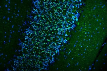 Immunofluorescent staining of FFPE rat cerebellum tissue with CAMKIV antibody (green) and DAPI nuclear stain (blue). HIER: steam section in pH6 citrate buffer for 20 min.