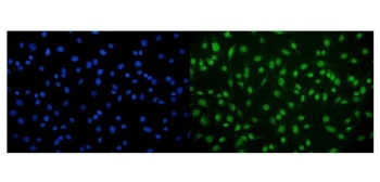 Immunofluorescent staining of FFPE mouse RM-1 cells with CAMKIV antibody (green) and DAPI nuclear stain (blue). HIER: steam section in pH6 citrate buffer for 20 min.