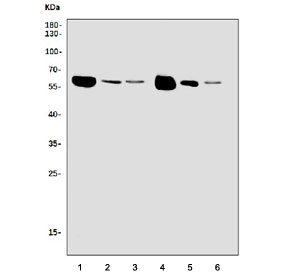 Western blot testing of 1) rat brain, 2) rat thymus, 3) rat testis, 3) mouse brain, 4) rat thymus and 6) rat testis tissue lysate with CAMKIV antibody. Predicted molecular weight ~58 kDa.
