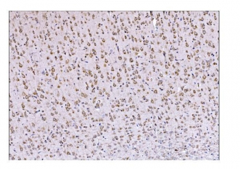 IHC staining of FFPE rat brain tissue with DLGAP1 antibody. HIER: boil tissue sections in pH8 EDTA for 20 min and allow to cool before testing.