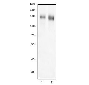 Western blot testing of 1) rat brain and 2) mouse brain tissue lysate with DLGAP1 antibody. Predicted molecular weight ~109 kDa but can be observed at up to ~130 kDa.