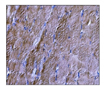 DYSF Antibody Skeletal Muscle IHC. Immunohistochemistry staining of FFPE human skeletal muscle tissue using DYSF Antibody demonstrates widespread cytoplasmic and sarcolemmal-associated HRP-DAB brown staining throughout skeletal muscle fibers. The staining pattern is consistent with expression of Dysferlin / DYSF, a ferlin family membrane repair protein that supports calcium-dependent sarcolemmal maintenance and recovery following muscle fiber injury. Signal is distributed along elongated myofibers with membranous accentuation, reflecting the established role of Dysferlin in membrane remodeling and preservation of muscle integrity in mechanically active tissues. HIER: boil tissue sections in pH8 EDTA for 20 min and allow to cool before testing.