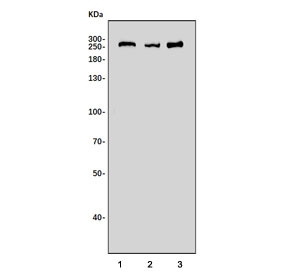 DYSF Antibody Multi-Species Heart WB. Western blot analysis of Lane 1: human PC-3 cell lysate, Lane 2: rat heart lysate, and Lane 3: mouse heart lysate using DYSF Antibody / Dysferlin Membrane Repair Protein Antibody. A band is detected at approximately 250-260 kDa in all three samples, corresponding to Dysferlin / DYSF. The observed molecular weight is modestly higher than the predicted molecular weight of approximately 237 kDa, which can occur with large membrane-associated proteins. Dysferlin is a ferlin family membrane repair protein that mediates calcium-dependent sarcolemmal restoration and maintenance of muscle cell integrity. Detection in rat and mouse heart lysates is consistent with the established expression of Dysferlin in contractile tissues that undergo continual mechanical stress and membrane remodeling.