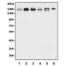 Western blot testing of human 1) PC-3, 2) HEK293, 3) U-87 MG, 4) A549, 5) U-2 OS and 6) rat testis lysate with EHMT2 antibody. Expected molecular weight: 160-180 kDa.