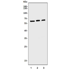 Western blot testing of human 1) U-87 MG, 2) HEK293 and 3) HeLa cell lysate with FTO antibody. Predicted molecular weight ~58 kDa.