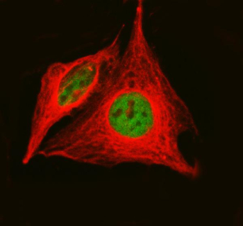 Immunofluorescent staining of FFPE human HeLa cells with Histone acetyltransferase 1 antibody (green) and Alpha Tubulin mAb (red). HIER: steam section in pH6 citrate buffer for 20 min.