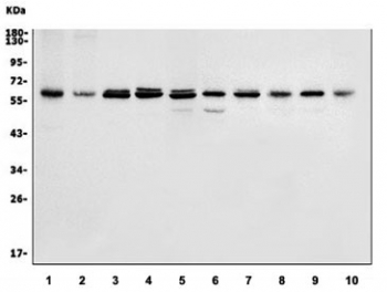 Western blot testing of 1) human K562, 2) human ThP-1, 3) human HL60, 4) human Caco-2, 5) human HepG2, 6) rat brain, 7) rat lung, 8) rat pancreas, 9) mouse brain and 10) mouse lung lysate with HDAC2 antibody. Predicted molecular weight: 55-60 kDa.
