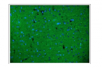 Immunofluorescent staining of FFPE rat brain tissue with Neurofilament-66 antibody (green) and DAPI nuclear stain (blue). HIER: steam section in pH6 citrate buffer for 20 min.