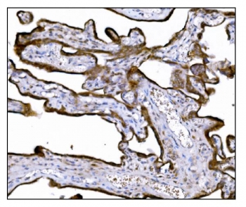 IHC staining of FFPE human placental tissue with LRP1B antibody. HIER: boil tissue sections in pH8 EDTA for 20 min and allow to cool before testing.