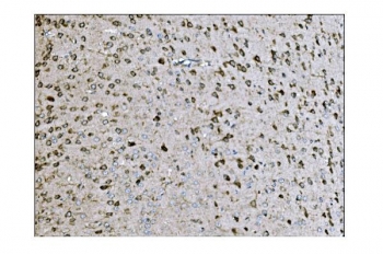 IHC staining of FFPE mouse brain tissue with LRP1B antibody. HIER: boil tissue sections in pH8 EDTA for 20 min and allow to cool before testing.