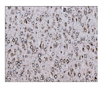 IHC staining of FFPE rat brain tissue with LRP1B antibody. HIER: boil tissue sections in pH8 EDTA for 20 min and allow to cool before testing.