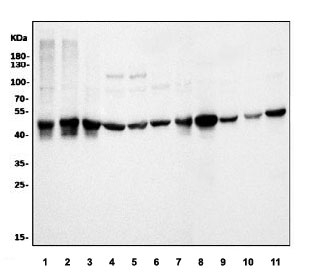 Western blot testing of human 1) K562, 2) A431, 3) HEK293, 4) Caco-2, 5) U-87 MG, 6) HepG2, 7) U-2 OS, 8) rat kidney, 9) rat testis, 10) mouse brain and 11) mouse kidney lysate with Ornithine Aminotransferase antibody. Predicted molecular weight ~49 kDa.