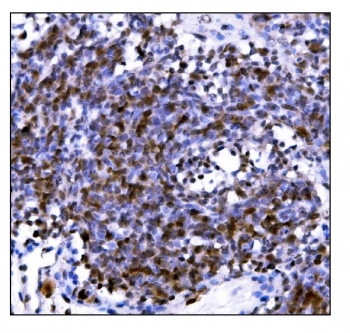 IHC staining of FFPE rat lymph node tissue with Protein PML antibody. HIER: boil tissue sections in pH8 EDTA for 20 min and allow to cool before testing.